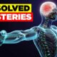 10 UNSOLVED Mysteries of the Human Body