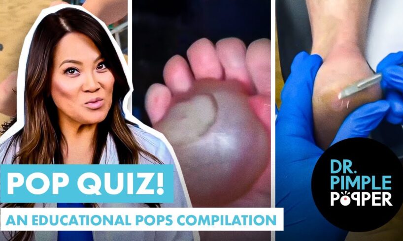 Dr Pimple Popper Pop Quiz! An Educational Pops Compilation