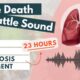 What does the death rattle sound like? | Signs of approaching death